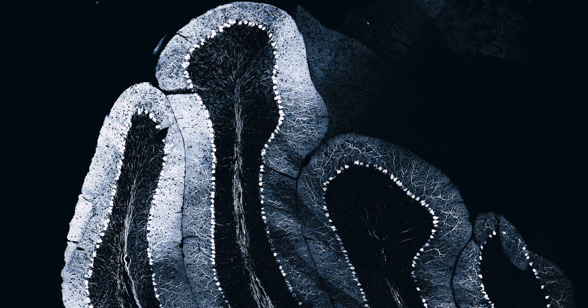Neurônios vistos ao microscópio com marcação fluorescente